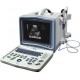 ORZ-8000A Portable B mode Ultrasound Scanner