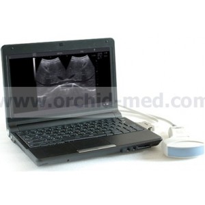 ORC-6102 Notebook Digital Diagnostic Ultrasound System for Human and Veterinary Use
