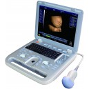 4D Laptop Ultrasound Scanner US-502