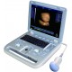 4D Laptop Ultrasound Scanner US-502